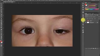 How to Fix Uneven Eyes by Using Clone Stamp Tool in Photoshop [upl. by Aicnetroh]