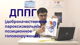 Доброкачественное позиционное пароксизмальное головокружение ДППГBPPV [upl. by Winchester]