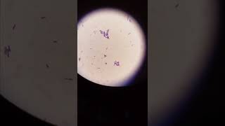 B cereus microbiology bacteria bacillus diarrhoea science [upl. by Ynnej335]