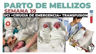 PARTO DE MELLIZOS SEMANA 39 UCI 10HRS DE CIRUGIA TRANSFUSION [upl. by Rasecoiluj]