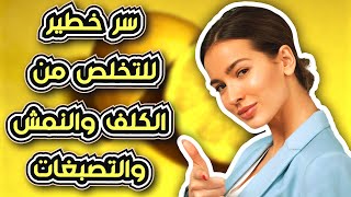 التخلص من الكلف والنمش والتصبغات وبصفة نهائية بهذا السر من عند دكتور معروف [upl. by Otir]