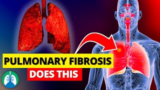 Pulmonary Fibrosis Does THIS to Your Lungs [upl. by Eycats391]