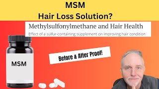 MSM for Fuller Healthier Hair Growth Latest Research [upl. by Charie512]