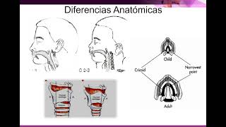 3 Oxigenoterapia y manejo de la vía aérea pediátrica [upl. by Neelehtak428]