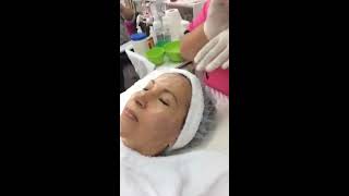 Terapia LED  Dermapen en tratamientos de envejecimiento [upl. by Ardnaskela562]