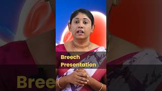 Breech presentation pregnancytips normaldelivery baby drsavitha udumalpet [upl. by Neeron749]