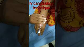 Iv cannulation technique mbbs doctor nursing viralvideo motivation shorts [upl. by Edla]