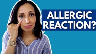 Allergic Reaction to Eye Makeup  Eye Doctor Explains [upl. by Noicpecnoc]