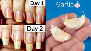 How to Grow Nails in 2 Days  How to Grow Nails Fast  jyoticachauhan [upl. by Zosema]