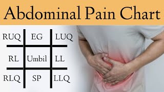 Abdominal Pain Causes by Location and Quadrant Differential Diagnosis Chart [upl. by Adlar]