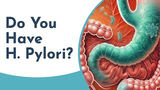 How to Diagnose H Pylori Tests and Procedures Explained [upl. by Sedrul593]