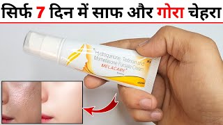 Melacare Cream Review  melacare cream  how to use melacare cream [upl. by Eimmac]