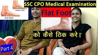 SSC CPO Medical Examination Flat Foot [upl. by Ivon15]