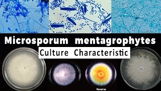 Trichophyton mentagrophytes culture Characteristic [upl. by Stephie]