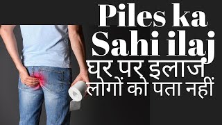 Piles treatment at home in Hindi  Bavasir ka ilaj [upl. by Bolen]