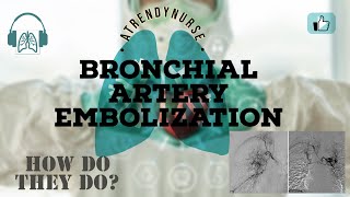 What Is Bronchial Artery Embolization  How They Are Doing It [upl. by Armstrong]