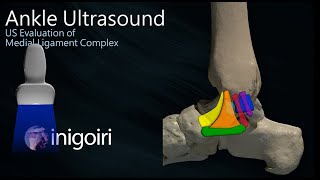 ANKLE ULTRASOUND MEDIAL LIGAMENT COMPLEX EVALUATION [upl. by Roswald]