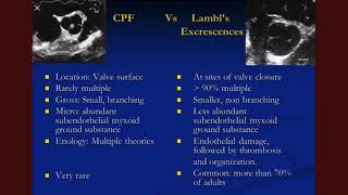 Lambls excrescences [upl. by Island]