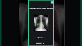 Bronchial breathing Sound in the Lungs Cause  Treatment Episode5 [upl. by Ahsinan]