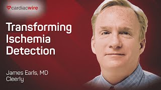 The Cardiac Wire Show – Transforming Ischemia Detection [upl. by Ribak]