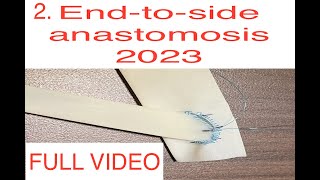 Endtoside vascular anastomosis fixed donor limb 2024 extended [upl. by Rapsag]