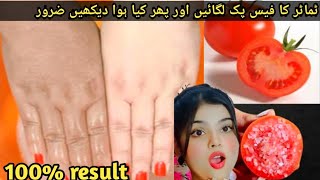 Hand whitening secret home remedies  Hand whitening cream 😱  Manicure at home  viral [upl. by Ettenahs59]