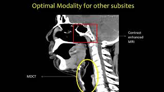 Head and Neck Anatomy Dr Abhishek Mahajan [upl. by Robb]