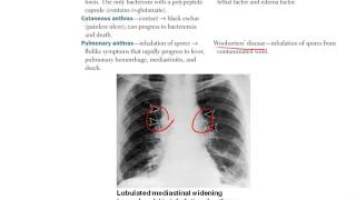 5 Microbiology CLINICAL Bacteriology Part 2 [upl. by Wilburn]