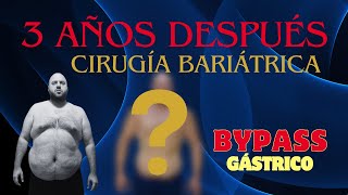 CAMBIO FÍSICO 3 AÑOS DESPUÉS DE UN BAYPASS GÁSTRICO [upl. by Enial]