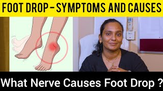 Foot Drop  पैर गिरना in Hindi लकवे के बाद पंजा नही उठने का ट्रीटमेंट  How to treat Foot Drop [upl. by Sterner521]