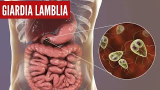 Giardia lambia ciclo de vida microscopio [upl. by Pul]