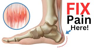 4 Exercises to Fix Achilles Tendonitis FAST [upl. by Nawd]