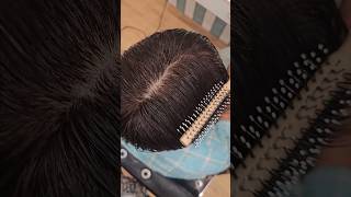 Best Hair Patch for Mens  Miraj Hair patch  Delhi Hair Fixing shorts viralhairpatch [upl. by Zelda]