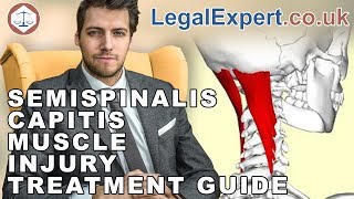 Semispinalis Capitis Muscle Injury Treatment Guide  2019  UK [upl. by Seto]