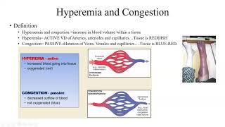 Pathology Made Easy 4 Hemodynamic Disorders [upl. by Levon797]