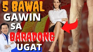 5 Bawal Gawin sa Baradong Ugat  Payo ni Doc Willie Ong [upl. by Scandura]