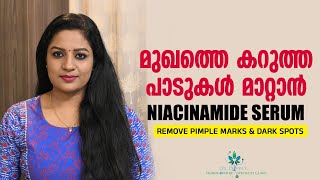 കറുത്തപാടുകൾ മാറ്റി മുഖം സുന്ദരമാക്കുവാൻ Niacinamide Face Serum To Remove Pimple Marks Dark Spots [upl. by Esined]