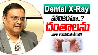 Advantage Of Dental XRay  Dental Treatment  Teeth Protection  Helthtips  Dhatri Health [upl. by Willie]