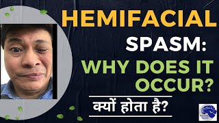 Hemifacial spasm Why does it happen Dr Jaydev Panchwagh [upl. by Messere]