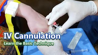 IV Cannulation  Learn the Basic Technique  IV Cannula [upl. by Aderfla790]