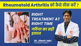 Rheumatoid Arthritis Treatment in Hindi  Osteoarthritis vs Rheumatoid Arthritis  Dr Jitesh Jain [upl. by Perzan]