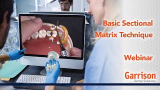 Basic Sectional Matrix Technique [upl. by Jarnagin3]