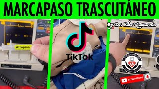 REPASO DE ARRITMIAS Parte 2Live por TikTok By Dr Zamarrón [upl. by Drandell759]