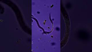 Curiosidade sobre o Lombriga Intestinal  Ascaris lumbricoides science biology [upl. by Redan648]