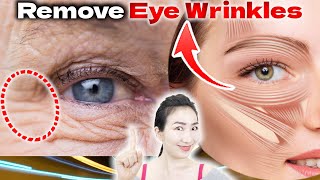 3 Essential Orbicularis Oculi Massages and Exercises to Remove Wrinkles Around the Eyes in 14 Days [upl. by Enomar]