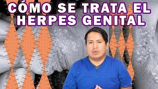 COMO ELIMINAR EL HERPES GENITAL [upl. by Thurstan763]