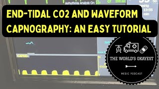 EndTidal CO2 and Waveform Capnography An Easy Tutorial Explicit [upl. by Gayel]