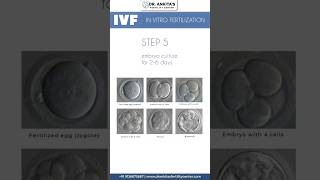 IVF Explained StepbyStep Process of In Vitro Fertilization [upl. by Ajam]