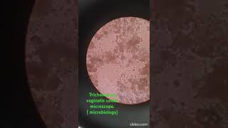 Trichomonas Vaginalis under microscope Microbiology [upl. by Ailime323]