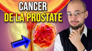 Les symptômes du CANCER de la PROSTATE que vous devez connaitre [upl. by Pyszka859]